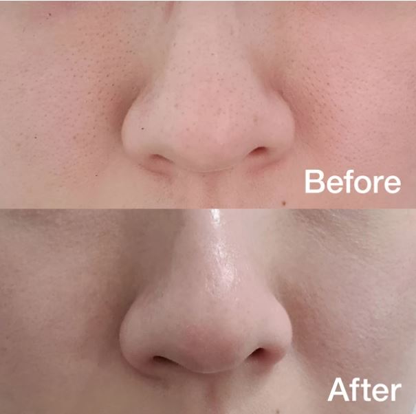 Medicube Zero Pore Pad - Image 4